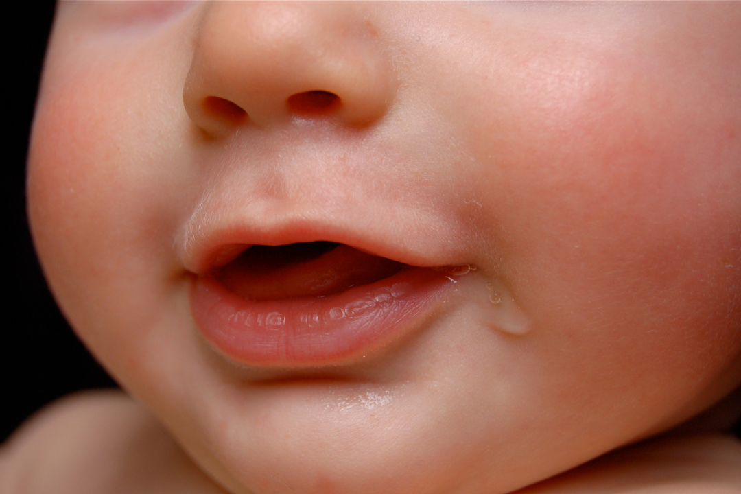 Close-Up of Baby's Lower Face with Saliva Dripping from the Side of the Mouth.